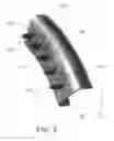 Fig. 03 - ATTACHABLE TEETH FOR CLEANING HAND TOOLS