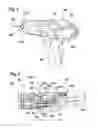 Fig. 02 - Hand-held machine tool having automatic shaft locking