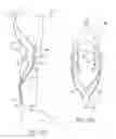 Fig. 14 - Twisted string actuators for an exosuit system