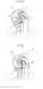 Fig. 06 - Joint structure capable of optimizing margin of length of umbilical member,  and industrial robot having the joint structure