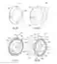 Fig. 26 - Locating ring and method for positioning parts