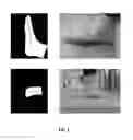 Fig. 05 - SYSTEMS AND METHODS FOR GENERATING ORTHOTIC DEVICE MODELS BY SURFACE MAPPING AND EXTRUSION