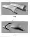 Fig. 08 - SYSTEMS AND METHODS FOR GENERATING ORTHOTIC DEVICE MODELS BY SURFACE MAPPING AND EXTRUSION