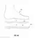 Fig. 09 - SYSTEMS AND METHODS FOR GENERATING ORTHOTIC DEVICE MODELS BY SURFACE MAPPING AND EXTRUSION