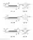 Fig. 12 - De-bonding and cleaning process and system