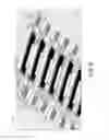 Fig. 08 - Fluid ejection device with ink feedhole bridge