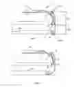 Fig. 03 - CLOSURE ASSEMBY