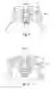 Fig. 07 - SPRAY CAN