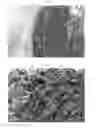Fig. 08 - CO-PROCESSING METHOD AND FORMULATION FOR HIV ATTACHMENT INHIBITOR PRODRUG COMPOUND AND EXCIPIENTS