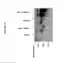 Fig. 52 - Codon optimized IL-15 and IL-15R-alpha genes for expression in mammalian cells