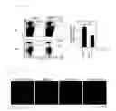 Fig. 05 - Inflammatory disease treatment composition including anti-myosin regulatory light-chain polypeptide antibody