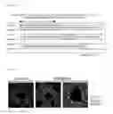 Fig. 08 - Inflammatory disease treatment composition including anti-myosin regulatory light-chain polypeptide antibody
