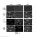 Fig. 02 - METHODS AND COMPOSITIONS FOR TREATING BRAIN DISEASES