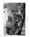 Fig. 16 - Acoustic perfusion devices
