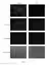Fig. 20 - Generation of keratinocytes from pluripotent stem cells and maintenance of keratinocyte cultures