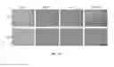 Fig. 21 - Generation of keratinocytes from pluripotent stem cells and maintenance of keratinocyte cultures