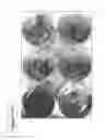 Fig. 100 - Isolation and cultivation of stem/progenitor cells from the amniotic membrane of umbilical cord and uses of cells differentiated therefrom
