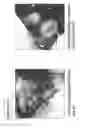 Fig. 101 - Isolation and cultivation of stem/progenitor cells from the amniotic membrane of umbilical cord and uses of cells differentiated therefrom