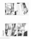 Fig. 107 - Isolation and cultivation of stem/progenitor cells from the amniotic membrane of umbilical cord and uses of cells differentiated therefrom