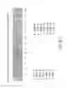 Fig. 12 - Isolation and cultivation of stem/progenitor cells from the amniotic membrane of umbilical cord and uses of cells differentiated therefrom