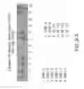 Fig. 18 - Isolation and cultivation of stem/progenitor cells from the amniotic membrane of umbilical cord and uses of cells differentiated therefrom