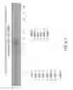 Fig. 20 - Isolation and cultivation of stem/progenitor cells from the amniotic membrane of umbilical cord and uses of cells differentiated therefrom
