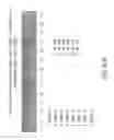Fig. 22 - Isolation and cultivation of stem/progenitor cells from the amniotic membrane of umbilical cord and uses of cells differentiated therefrom