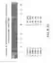 Fig. 23 - Isolation and cultivation of stem/progenitor cells from the amniotic membrane of umbilical cord and uses of cells differentiated therefrom