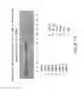 Fig. 30 - Isolation and cultivation of stem/progenitor cells from the amniotic membrane of umbilical cord and uses of cells differentiated therefrom