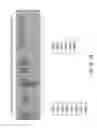 Fig. 31 - Isolation and cultivation of stem/progenitor cells from the amniotic membrane of umbilical cord and uses of cells differentiated therefrom