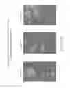 Fig. 45 - Isolation and cultivation of stem/progenitor cells from the amniotic membrane of umbilical cord and uses of cells differentiated therefrom