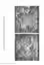 Fig. 82 - Isolation and cultivation of stem/progenitor cells from the amniotic membrane of umbilical cord and uses of cells differentiated therefrom