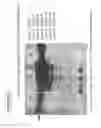 Fig. 88 - Isolation and cultivation of stem/progenitor cells from the amniotic membrane of umbilical cord and uses of cells differentiated therefrom