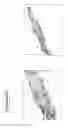 Fig. 96 - Isolation and cultivation of stem/progenitor cells from the amniotic membrane of umbilical cord and uses of cells differentiated therefrom
