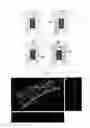 Fig. 12 - Device and method of 3-dimensionally generating in vitro blood vessels
