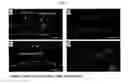 Fig. 13 - Device and method of 3-dimensionally generating in vitro blood vessels