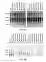 Fig. 12 - Restrictive inverted terminal repeats for viral vectors