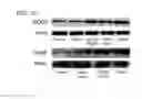 Fig. 03 - COMPOSITIONS AND METHODS FOR THE TREATMENT OF OCULAR OXIDATIVE STRESS AND RETINITIS PIGMENTOSA