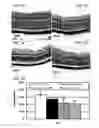 Fig. 06 - COMPOSITIONS AND METHODS FOR THE TREATMENT OF OCULAR OXIDATIVE STRESS AND RETINITIS PIGMENTOSA
