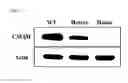 Fig. 11 - CMP-ACETYLNEURAMINIC ACID HYDROXYLASE TARGETING VECTOR, TRANSGENIC ANIMAL FOR XENOTRANSPLANTATION INTRODUCED WITH THE VECTOR, AND METHOD OF MANUFACTURING THE SAME