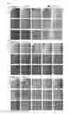 Fig. 05 - Rapid antimicrobial susceptibility test, based on an analysis of changes in morphology and growth pattern of a microbial cell under different concentrations of various antimicrobial agents, and automated cell image analysis system therefor