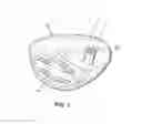 Fig. 02 - Method of forming golf club head assembly