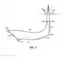 Fig. 02 - Bubble pump utilization for vertical flow line liquid unloading