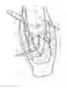 Fig. 04 - PULSE DETONATION COMBUSTOR