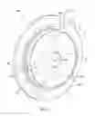 Fig. 04 - Heat shield with centering features