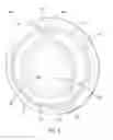Fig. 06 - Heat shield with centering features