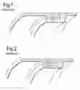 Fig. 02 - Joint assembly