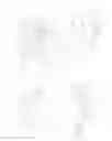 Fig. 05 - Clip-fastened raceway for a variable compression ratio engine