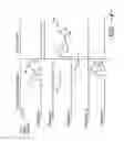 Fig. 04 - Method for operating an automatic transmission in a limp mode