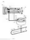 Fig. 08 - Hydraulic actuator lockout
